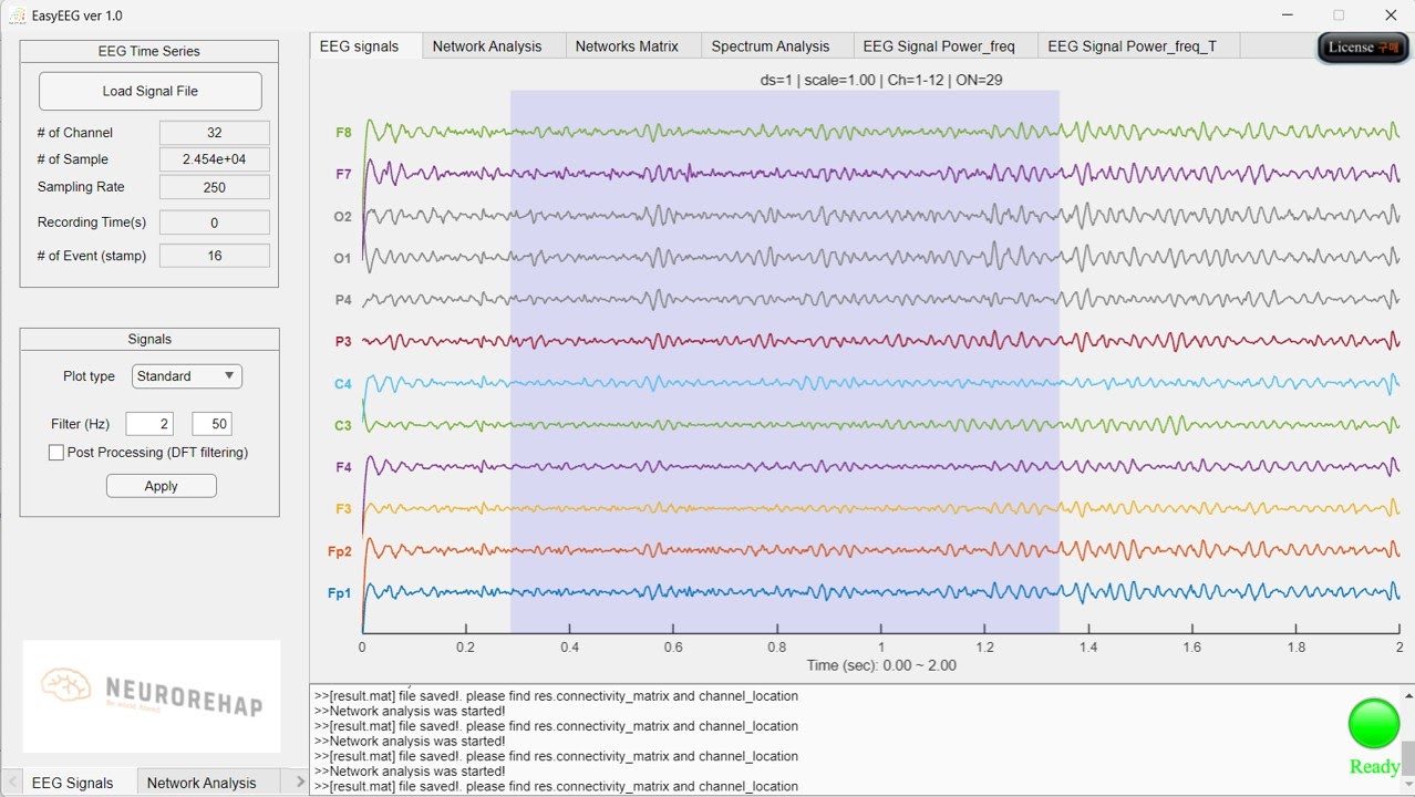 EasyEEG 소프트웨어 화면 — 다채널 EEG 신호와 분석 탭